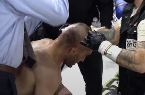 MMA kovotas neteko piršto